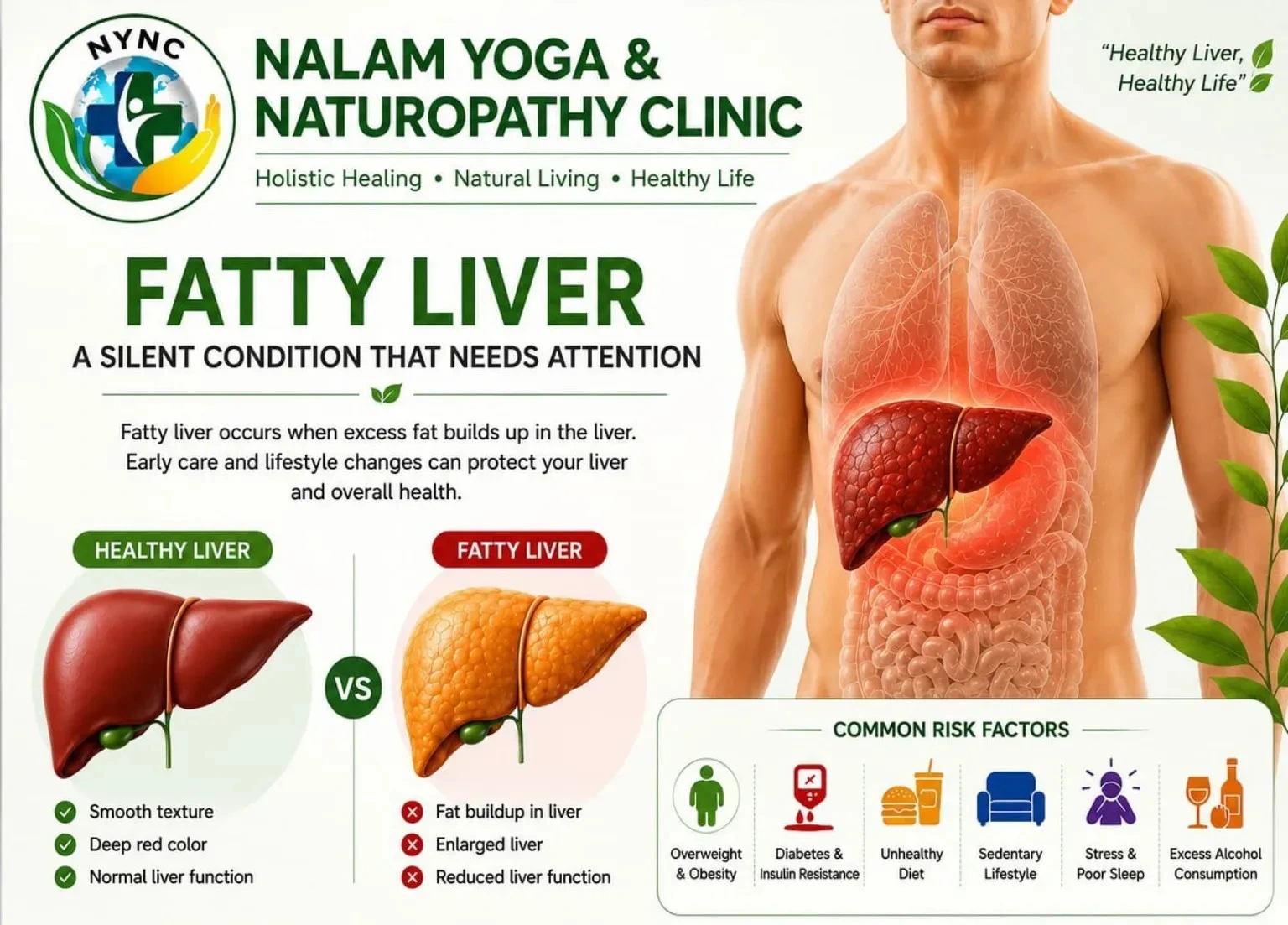 Naturopathy Treatment for Fatty Liver at Nalam